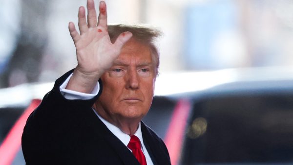 Trump adds to the mystery of those red spots on his hand — “Maybe it’s AI”