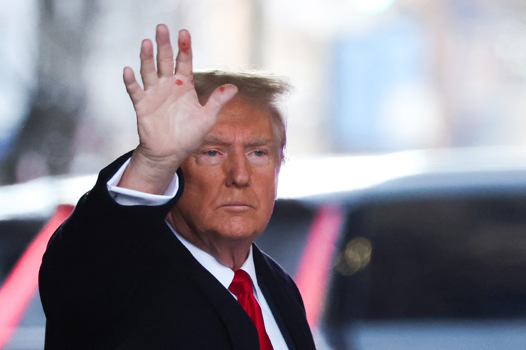 Trump adds to the mystery of those red spots on his hand — “Maybe it’s AI”