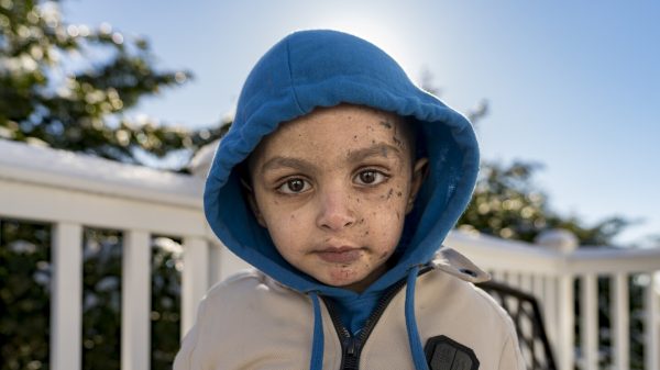 A 4-year-old Gaza boy lost his arm – and his family. Half a world away, he’s getting a second chance